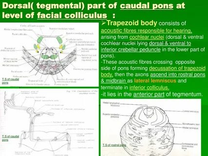 Parts translate