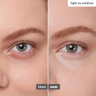 Eye brightening