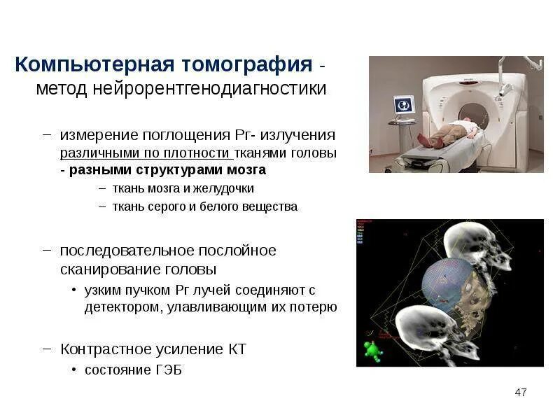 Компьютерная томография является методом. Кт сущность метода. метод компьютерной томографии. компьютерная томография мето. кт методы исследования.