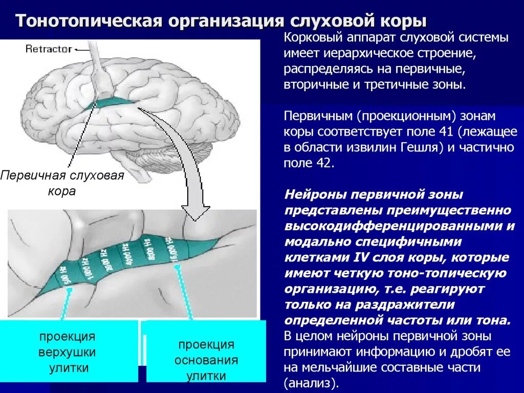 Слуховые стимулы. Тонотопическая организация слуховой системы. Строение слуховой коры.