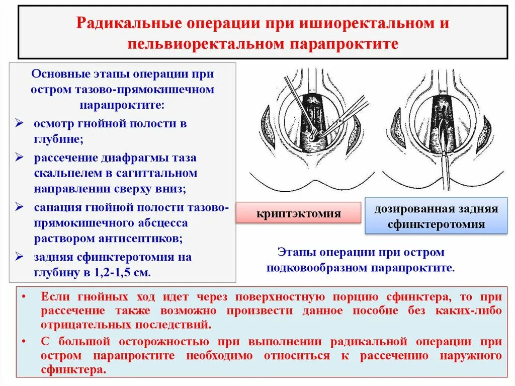Операция опасно или нет. Операция при ишиоректальном парапроктите. парапроктит этапы операции. острый пельвиоректальный парапроктит. острый парапроктит хирургическое лечение.