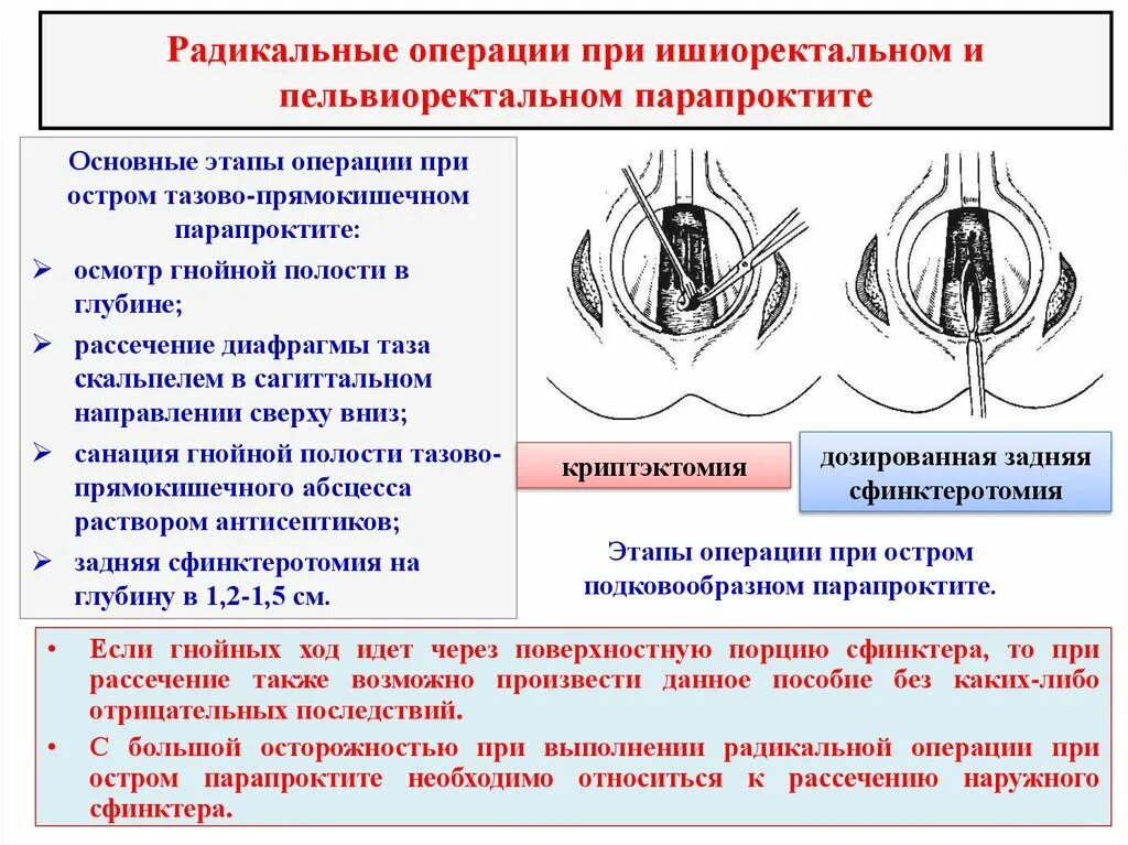 Операция при ишиоректальном парапроктите. Пельвиоректальный парапроктит операция. Парапроктит этапы операции. Что такое этапом радикальная операция. Назовите этапы операции