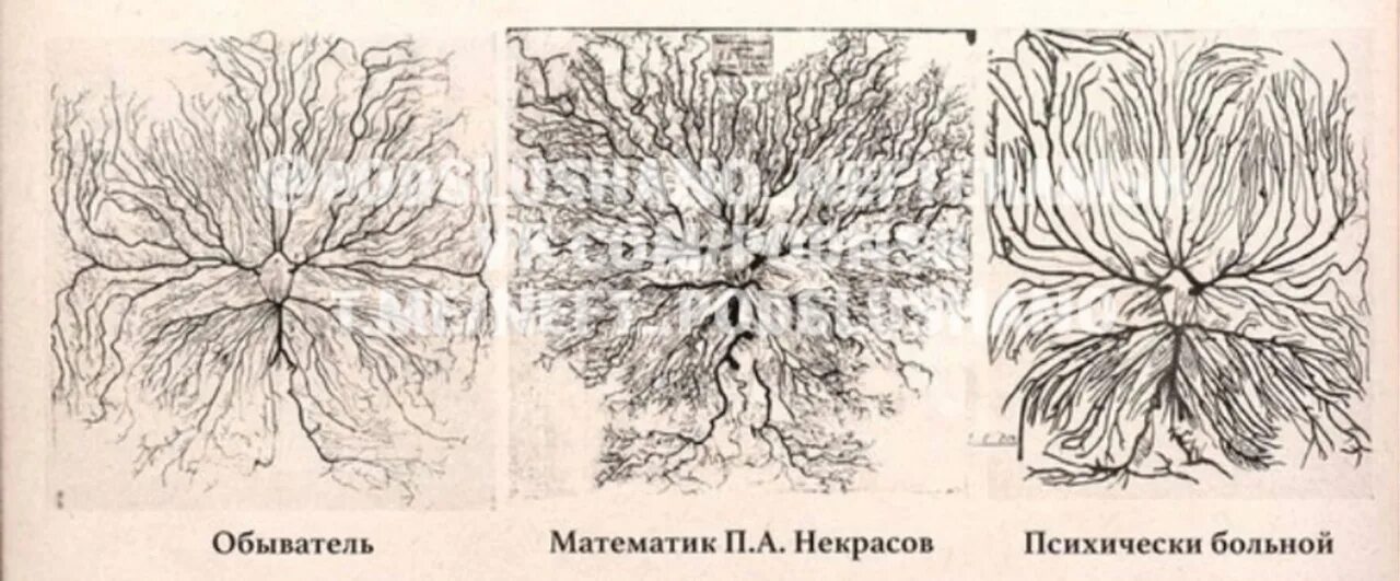 Матрица горяева для головного мозга. Мозг математика и извозчика. Мозг профессора и извозчика. Мозг профессора математики. Сосудистая система мозга профессора и извозчика.