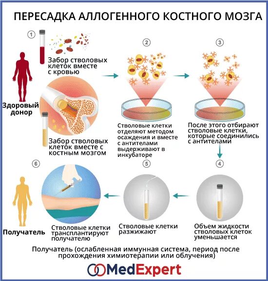 Пересадка клеток мозга. Трансплантация стволовых клеток костного мозга. Трансплантация гемопоэтических стволовых клеток (ТГСК). Трансплантация стволовых клеток схема. Физиологические основы пересадки костного мозга..