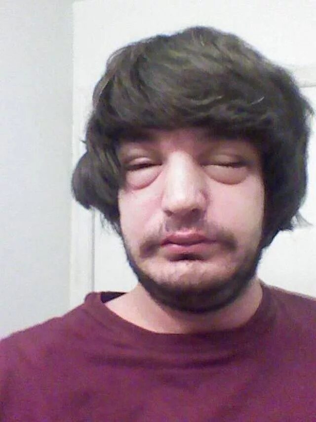 Альберт ситдиков. Человек укус пчелы. Пчеловод василий. Человек укус пчелы. Человек укус пчелы.