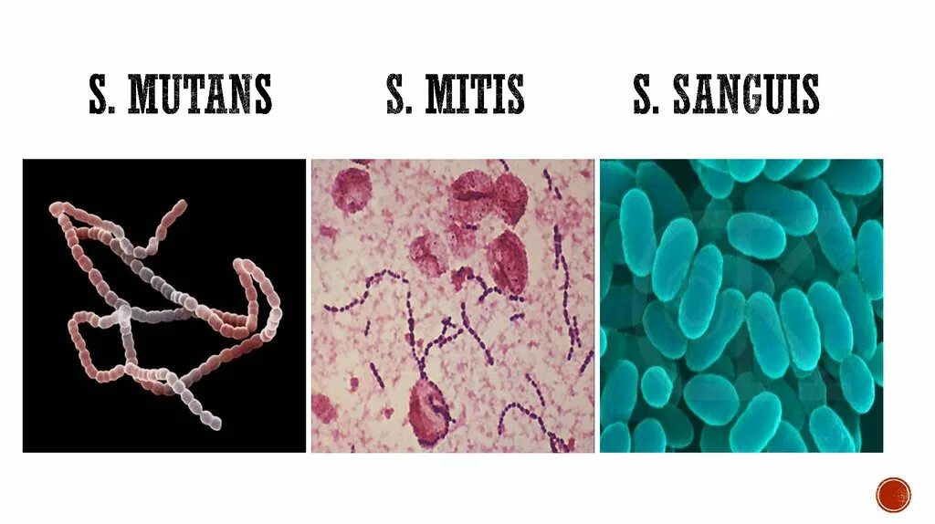 Микрофлора языка. Стрептококк мутанс микробиология. S Sanguis микробиология. Streptococcus Mutans в полости рта.