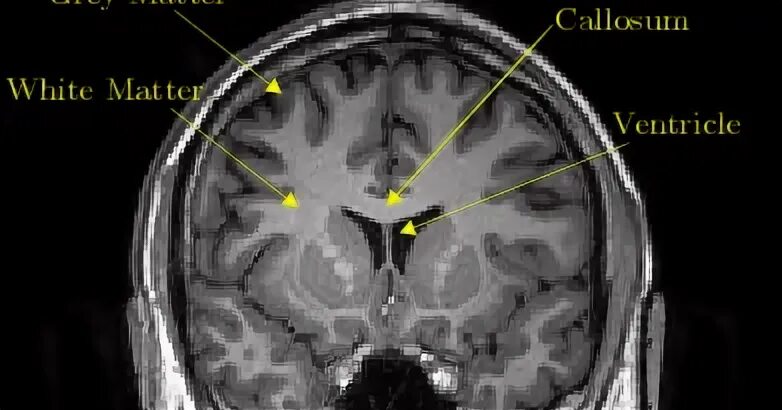 Grey matter. Grey matter