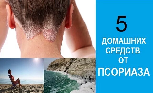Эффективно вылечить псориаз. Избавление от псориаза.