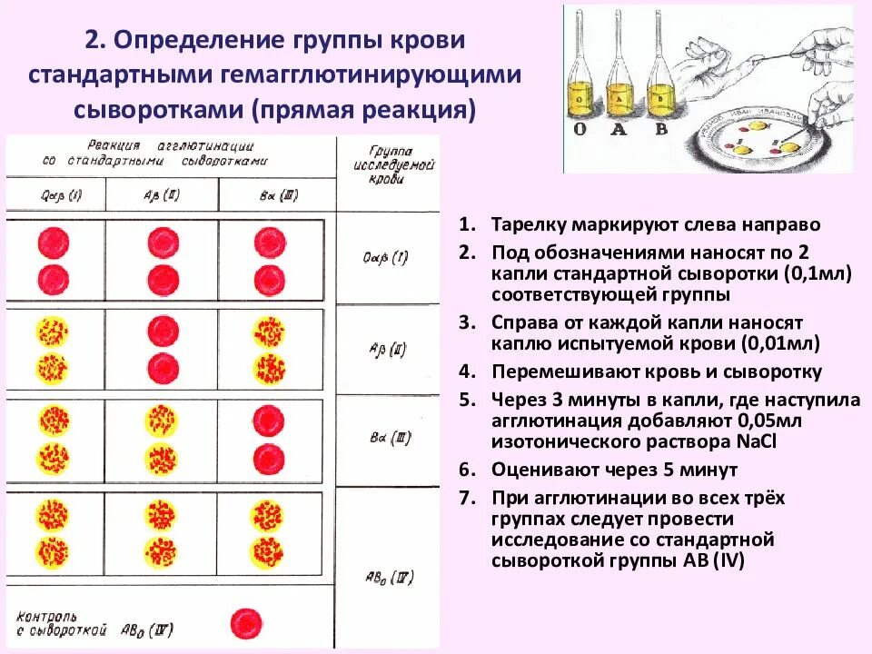 Определить группу крови с помощью стандартных сывороток. Метод определения крови стандартными сыворотками. Определение 2 группы крови стандартными сыворотками. Маркировка стандартная сыворотка для определения группы крови 2. Резус фактор экспресс методом