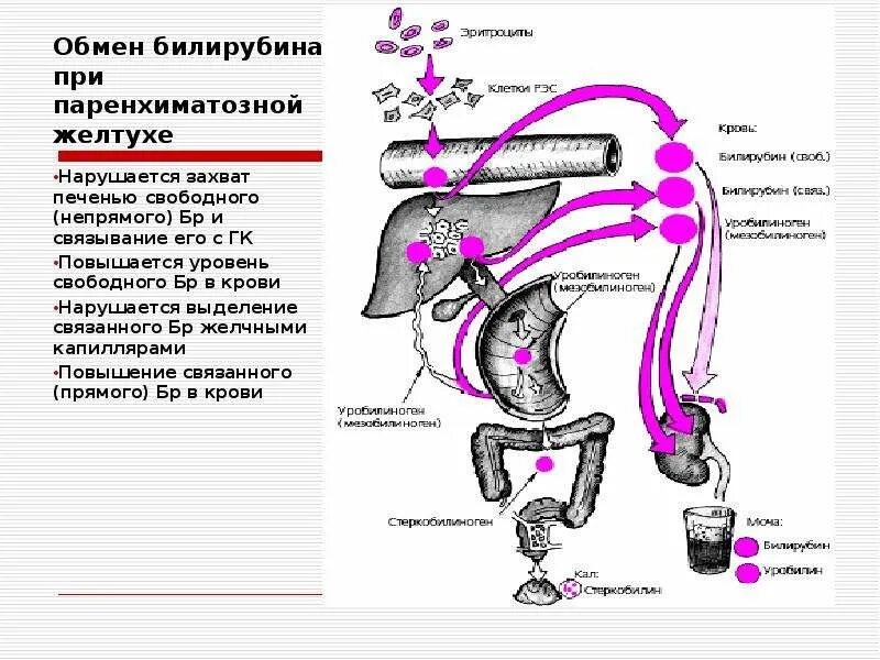 Печеночная желтуха билирубин. Обмен билирубина. прямой билирубин при паренхиматозной желтухе. желчный пузырь билирубин. повышение прямого билирубина причины.