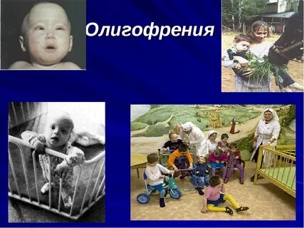 Олигофрен кто это