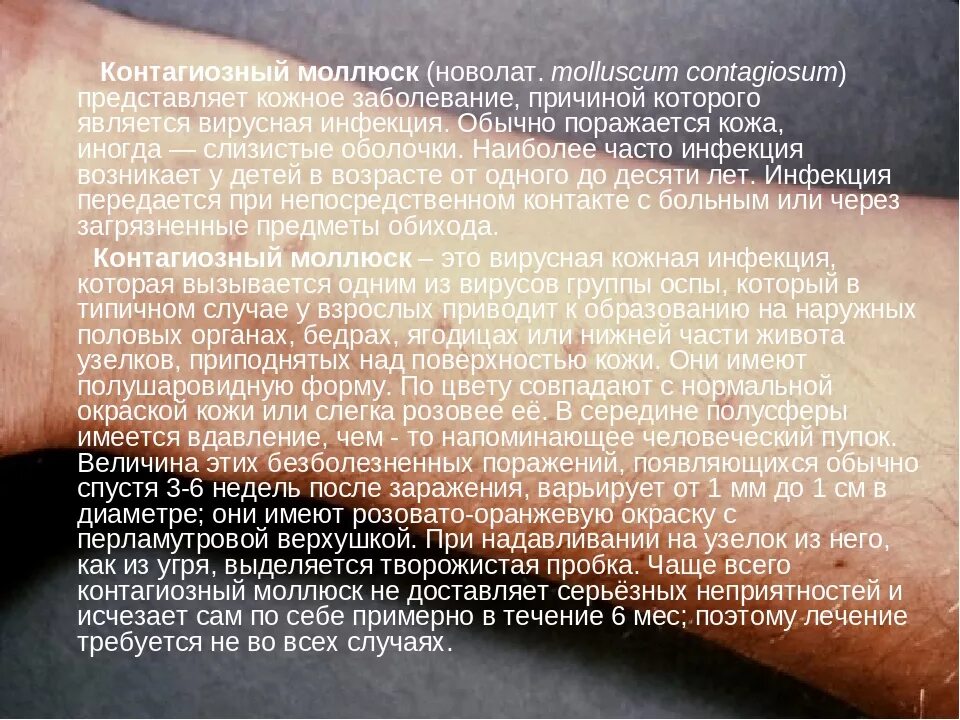При регистрации случаев заболевания контагиозными ответ