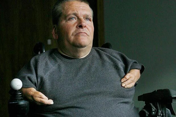 Талидомид. Профессор ленц талидомид. талидомидовой трагедии. талидомид трагедия дети.