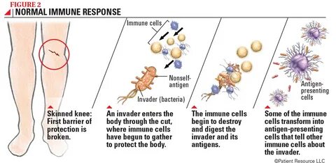 Response body