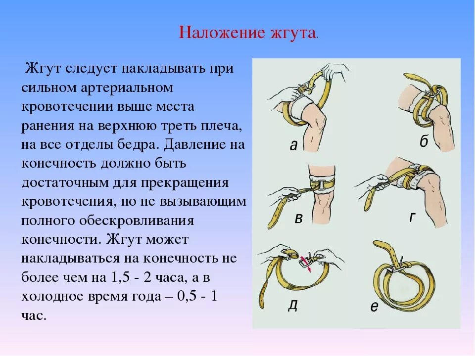 На какое время накладывают артериальный жгут. Как нпкладывается жгкь. Наложение жгута при кровотечениях. Жгут при кровотечении накладывается. Наложение кровоостанавливающего жгута при кровотечении.