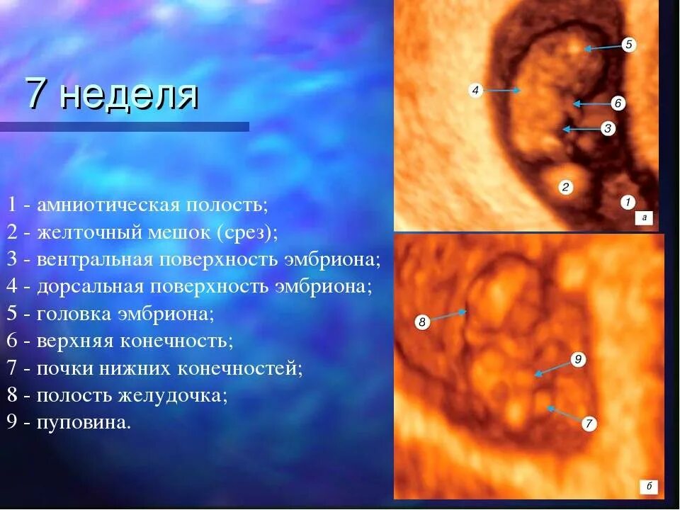 7 недель желточный. Желточный мешочек 4,6 мм. Желточный мешок 0.26. Желточный мешок яйцеклетка.