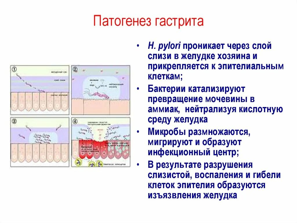 Схема лечения хронического аутоиммунного гастрита. Helicobacter pylori патогенез. Механизм развития хронического гастрита. Острый и хронический гастрит этиология. Патогенез эндогенного гастрита.