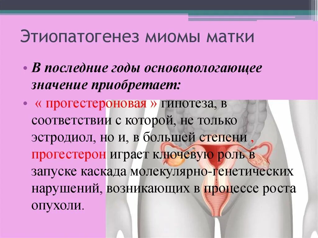 Миома матки жалобы. Этиопатогенез миомы матки. Миома матки этиология. Миома матки этиология и патогенез.