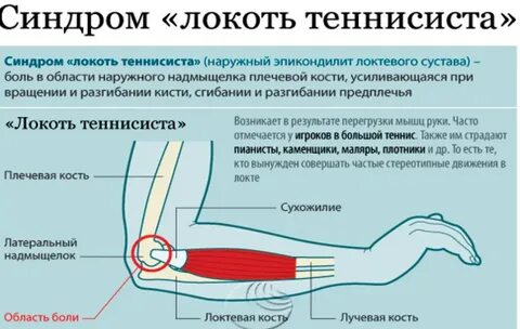 Ночью немеют руки до локтя причины