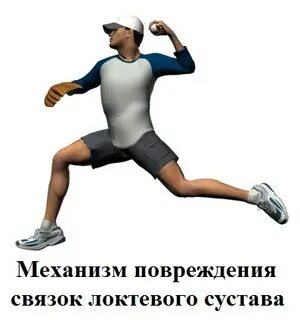 Закрытое повреждение связок