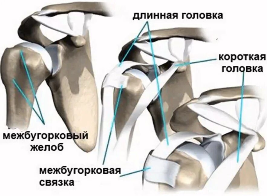 Акромион плечевого сустава. Тенодез длинной головки бицепса плечевого сустава. Подвывих сухожилия длинной головки бицепса.