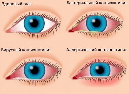 Что значат синие и красные глаза