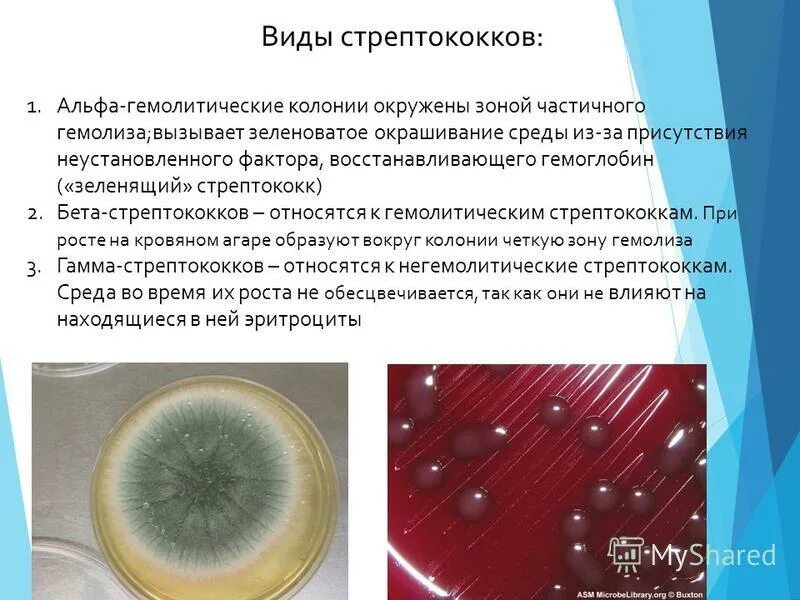 Инфекции бета-гемолитического стрептококка группы а. Факторы патогенности бгса. Бета гемолитический стрептококк группы а ревматизм. Бета гемолитический стрептококк группы а. Бета гемолитический стрептококк.
