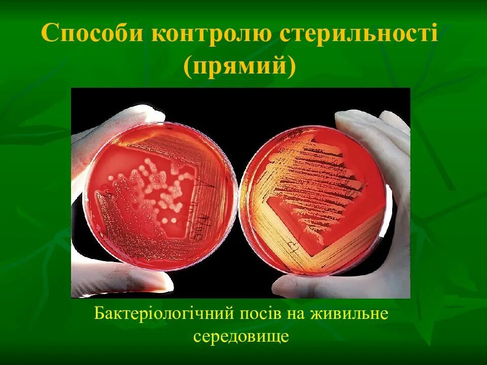Бактериологический метод стерилизации. Бактериологический контроль стерильности. методы контроля стерилизации бактериологический. прямой метод контроля стерильности. методы бактериологического контроля стерильности.