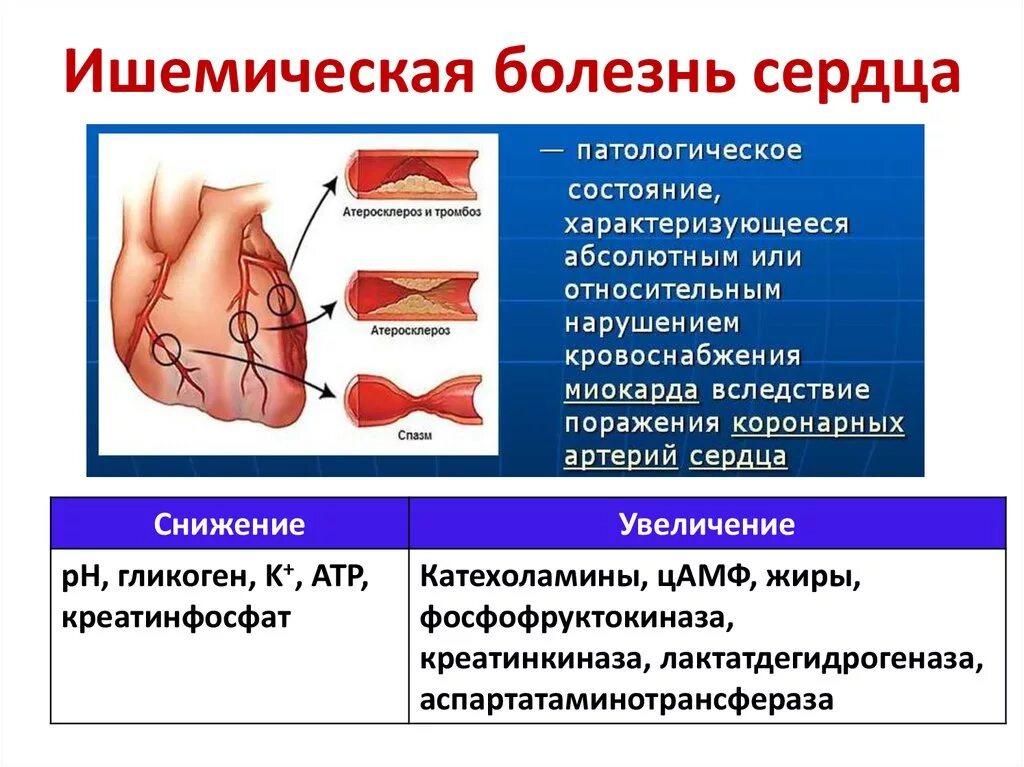 Симптомы ибс у мужчин. Ишемическая болезнь сердца симптомы. Синдром ишемической болезни сердца симптомы. Ишемические поражения сердца.