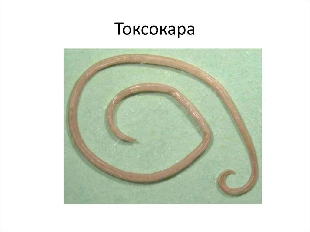 Токсокары у детей симптомы. Токсокары у детей симптомы