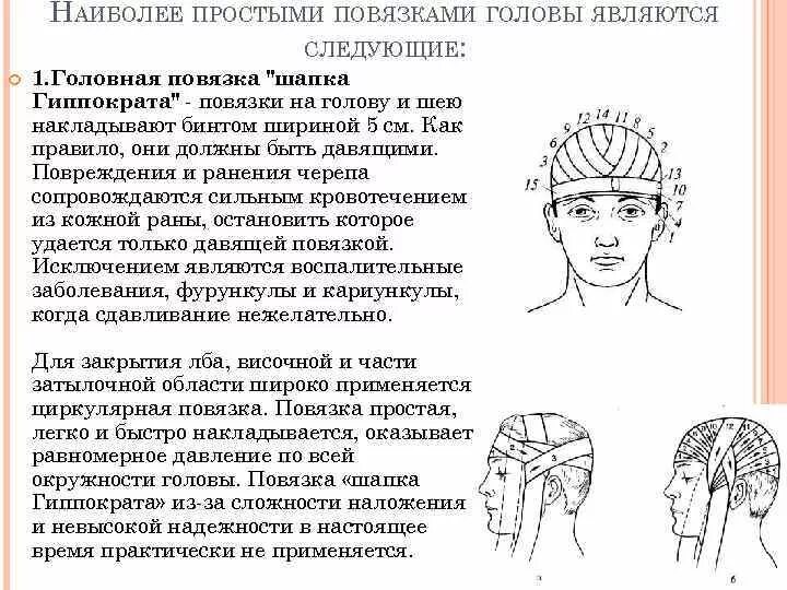 Повязка шапка Гиппократа техника наложения. Повязка "шапка Гиппократа".43. Повязок «шапка Гиппократа» и «чепец».. Наложение повязки при травме головы. Болит шапка головы