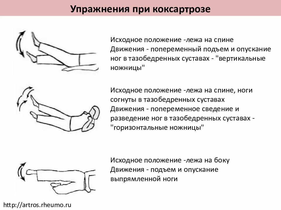 Комплекс упражнений при коксартрозе тазобедренного сустава 2 степени. Упражнения для тазобедренного сустава при коксартрозе 1 степени. ЛФК при коксартрозе тазобедренного сустава 1. ЛФК при коксартрозе 1 степени. Гимнастика для коксартроза тазобедренного сустава 2