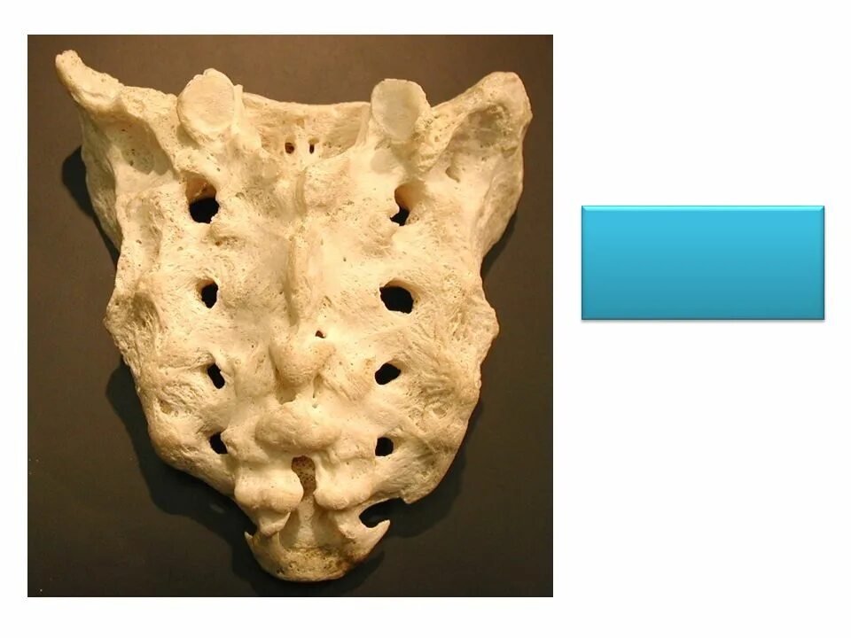 Крестец os Sacrum. Крестец анатомия. Крестец кость анатомия. Синостоз крестца. Органы крестцового отдела