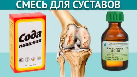 Сода суставы отзывы