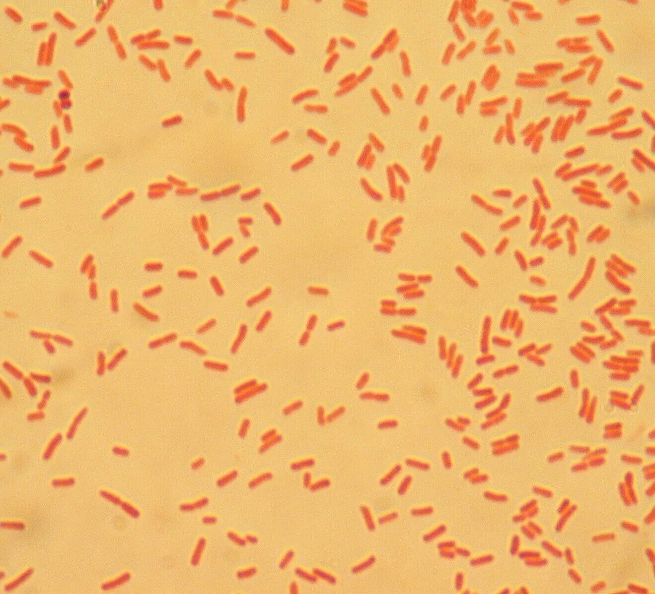Грамотрицательные кишечные палочки. Анализ мочи e coli норма. Escherichia coli в мазке у женщины норма. Бессимптомная бактериурия. Бгкп на эндо.