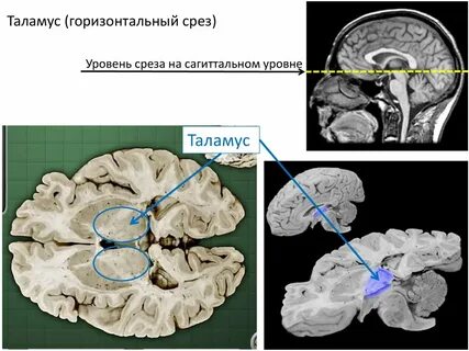 Уровень среза