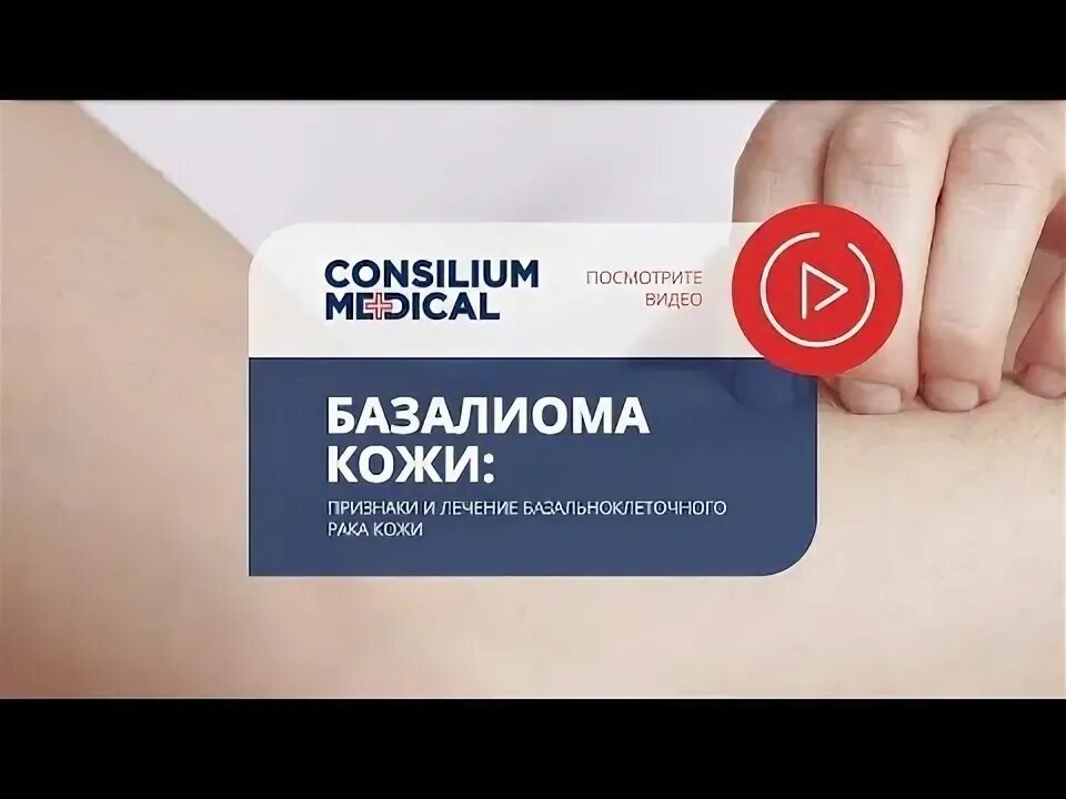 Базалиома на руке как выглядит Фиброма: виды, причины, признаки, симптомы и лечение