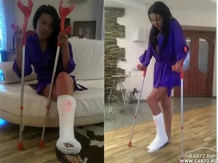 Мама сломала ногу