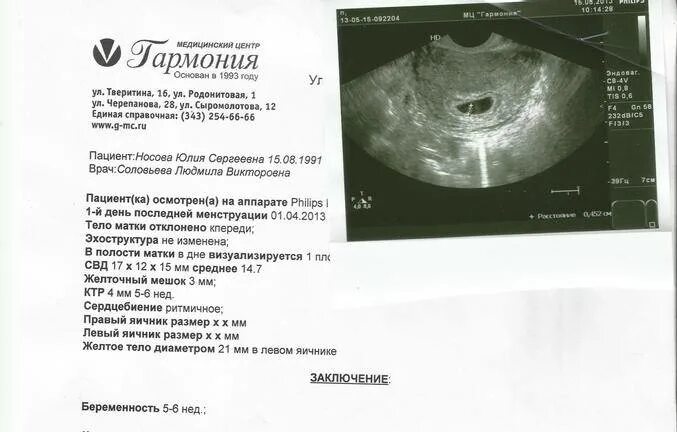 Размер плода на 6 неделе. Диаметр желточного мешка 3.5 мм. СВД 18,6 мм желтый мешок 7 мм КТР 2.3 мм УЗИ. Акушерский срок 7-8 недель беременности размер плодного яйца. Желточный мешок на УЗИ 6 недель.