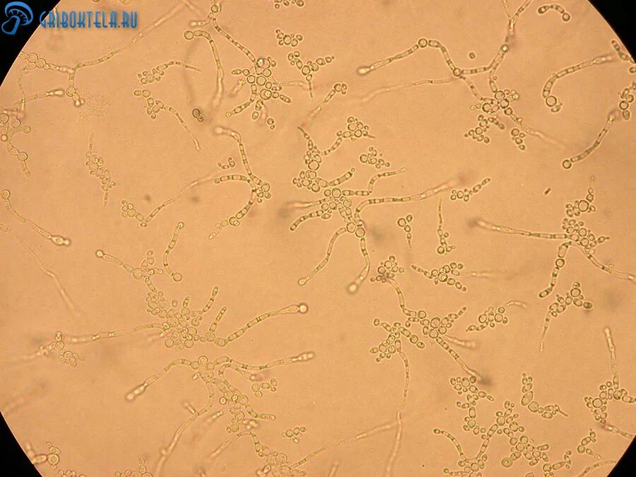 Грибы кандида микроскопия. Мицелий грибов в моче микроскопия. Мицелий грибов кожи микроскопия. Кандида альбиканс микроскопия.