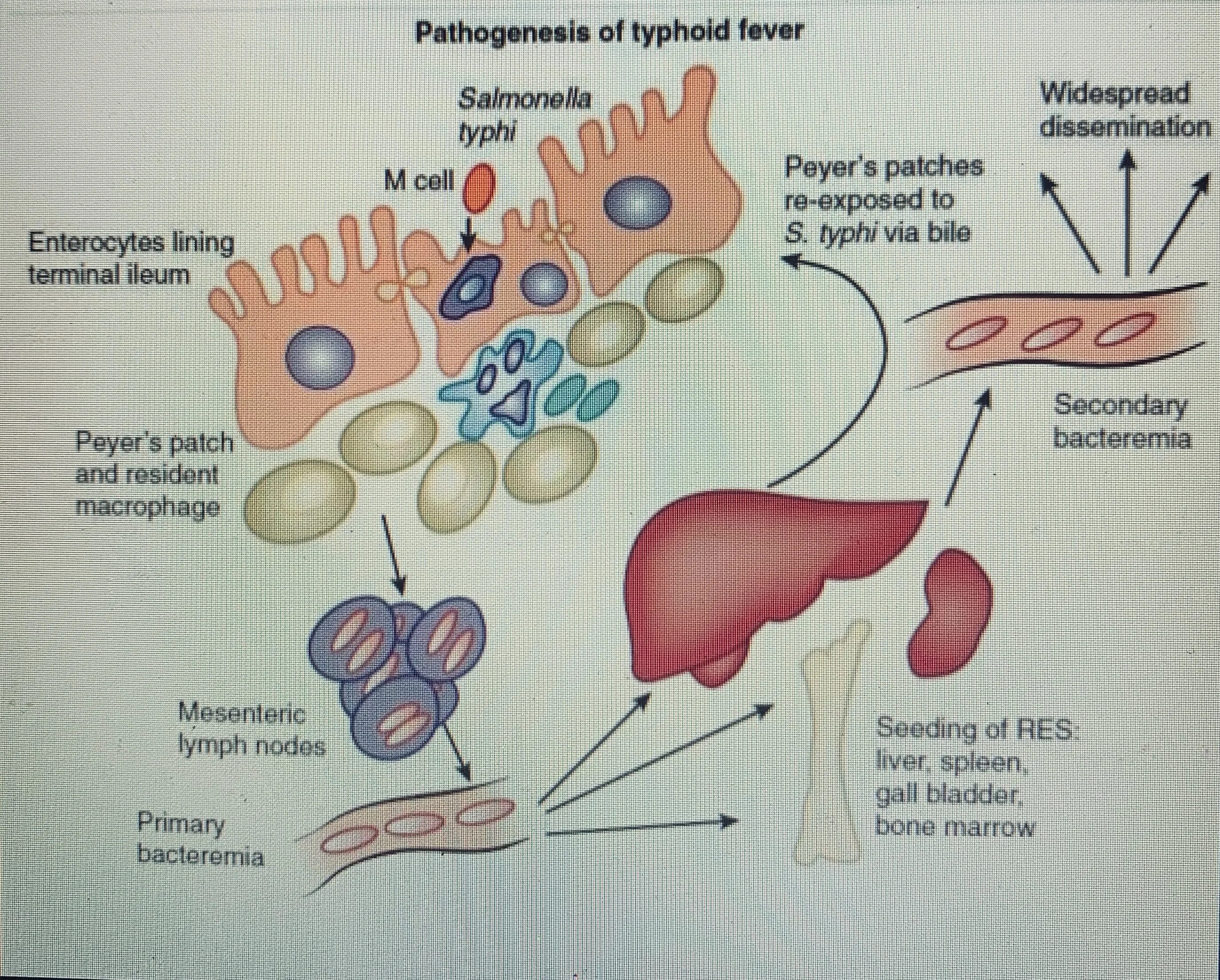 Salmonella enterica. Salmonella enterica патогенез. Патогенез брюшного тифа. Брюшной тиф патогенез схема.