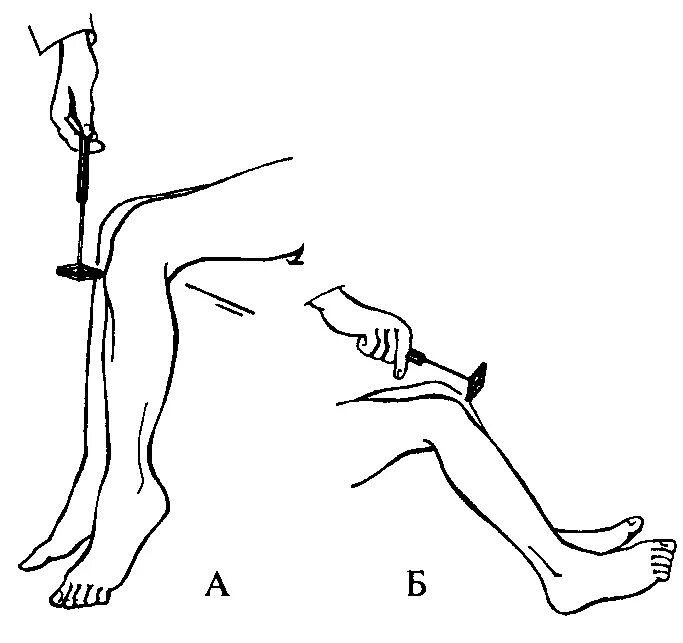 Коленный рефлекс лежа. Исследование коленного рефлекса лежа. Рефлексы молоточком.