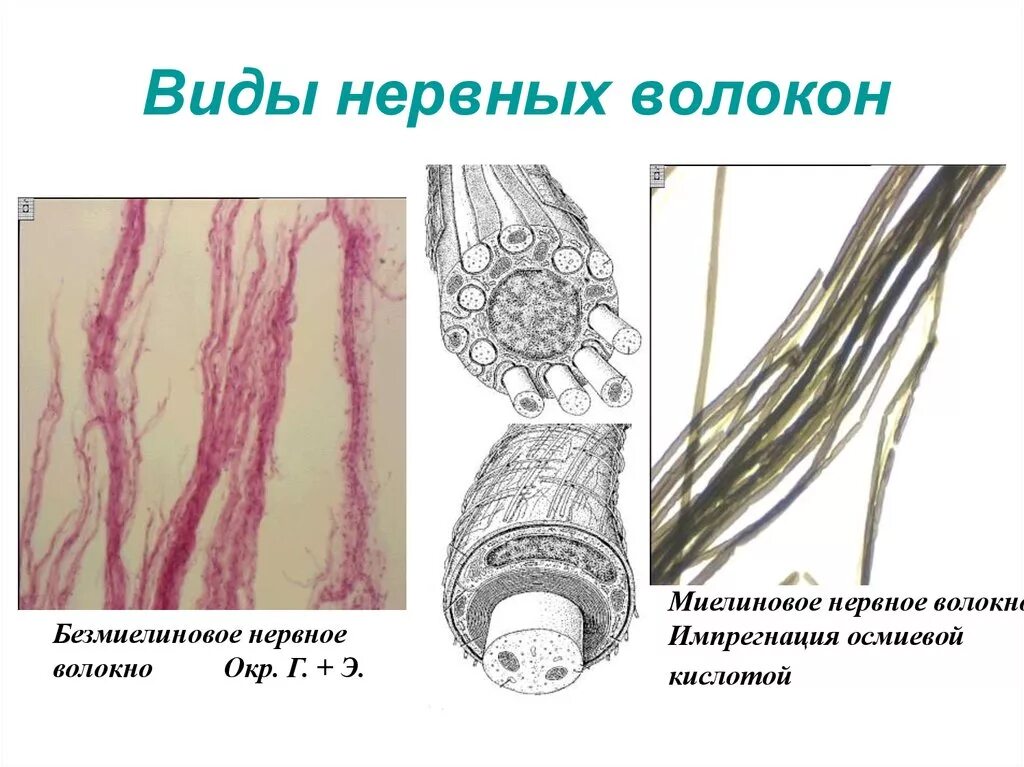 Строение нерва рисунок. Безмякотные нервные волокна строение. Миелиновые нервные волокна рисунок. Безмиелиновое нервное волокно рисунок. Типы миелиновых нервных волокон.