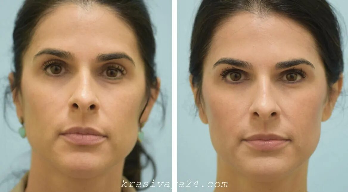 Скулы на лице. Болит и сводит челюсть при зевании. Скулы у девушек. Там где я там жизнь проходит. Почему сводит скулы.