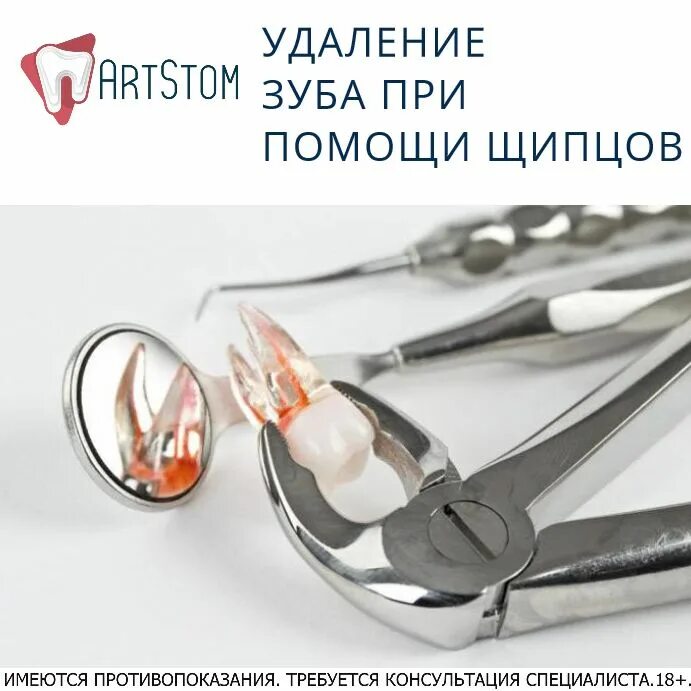 Какими инструментами вырывают зубы