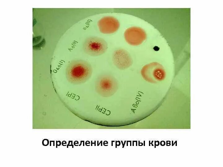 Тарелка для определения группы крови. Тарелка для группы крови. Группа крови по тарелке. Тарелка для определения группы крови как называется.