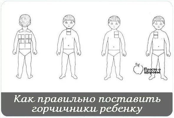 Горчичники детям. Горчичники ребенку при кашле 2,5 года. как поставить горчичники при кашле ребенку 4 года. как правильно ставить горчичники ребенку. горчичние прикашле детям.