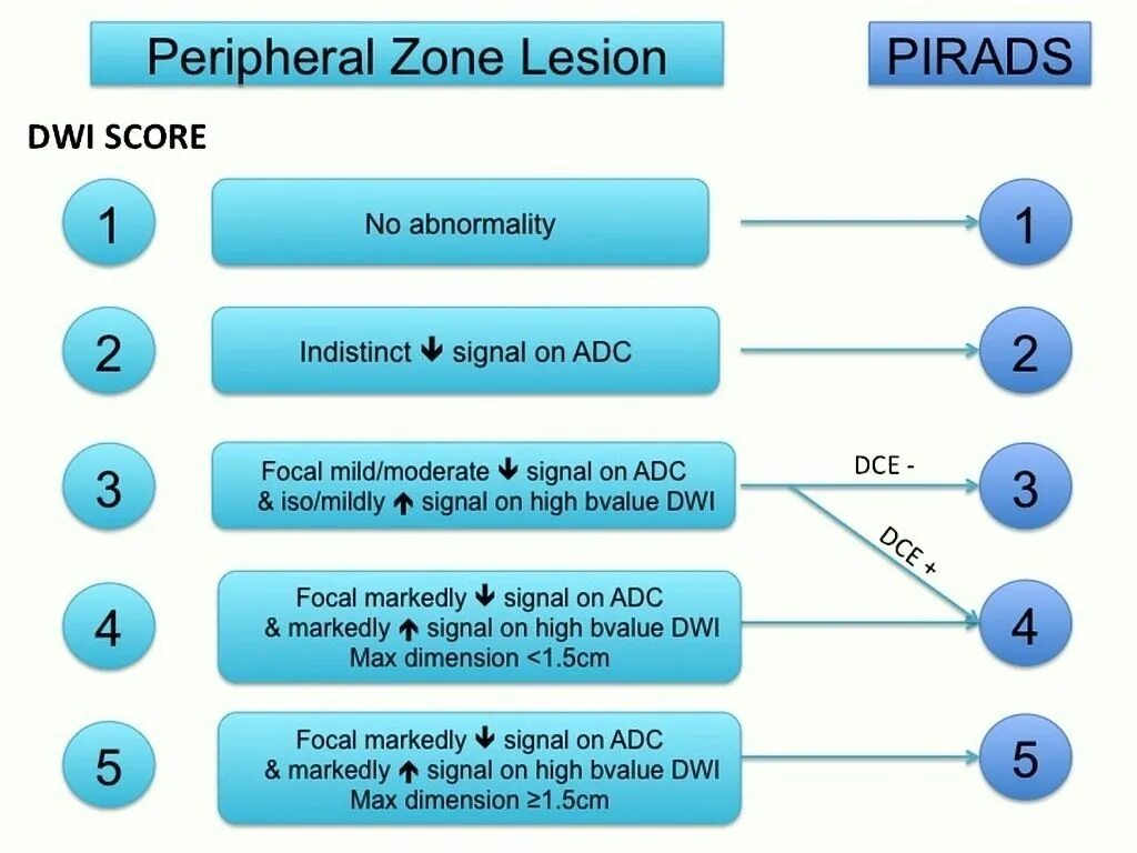 Предстательная железа pirads. Pi-rads 2.1 классификация. Шкала Pi rads предстательной железы. Схема Pirads.