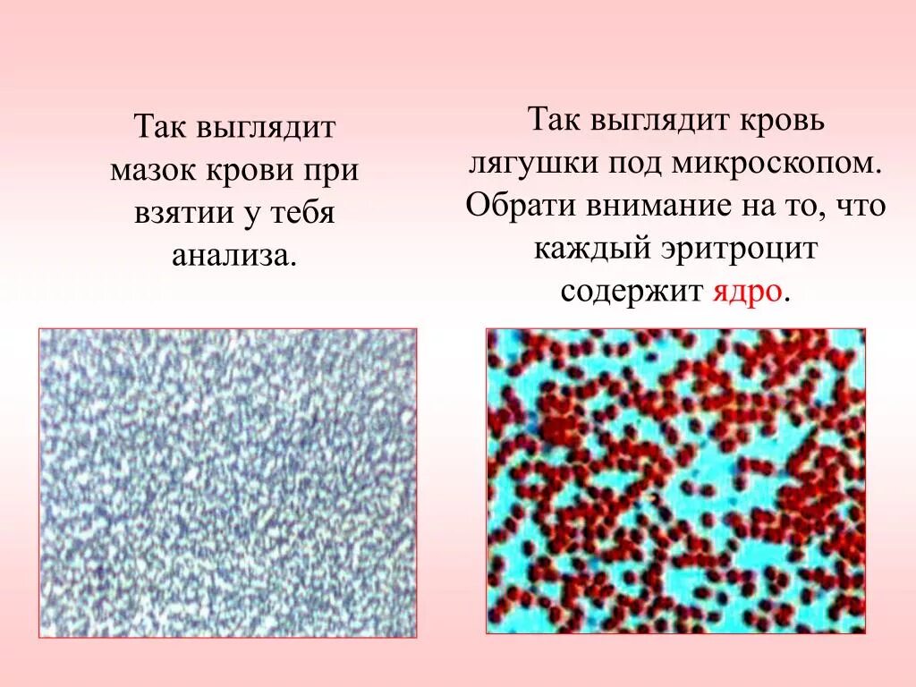 Исследование крови лягушки какая биологическая наука. Клетки крови человека и лягушки под микроскопом. Мазок крови лягушки. Кровь человека и кровь лягушки. Мазок крови лягушки под микроскопом.