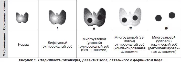 Диффузный нетоксичный. Зоб щитовидной железы диффузный диффузный многоузловой. Узловой зоб 1 стадии щитовидной железы. Эутиреоидный зоб классификация. Диффузный и Узловой токсический зоб классификация.